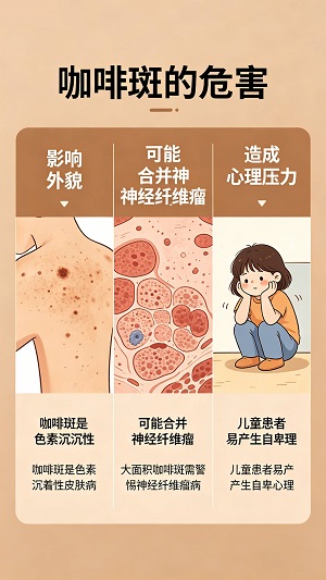 咖啡斑需要治疗吗？南京哪里能治疗咖啡斑？